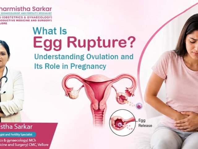 What Is Egg Rupture? Understanding Ovulation and Its Role in Pregnancy
