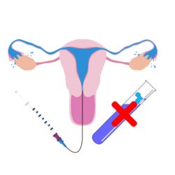 Recurrent IVF Failure